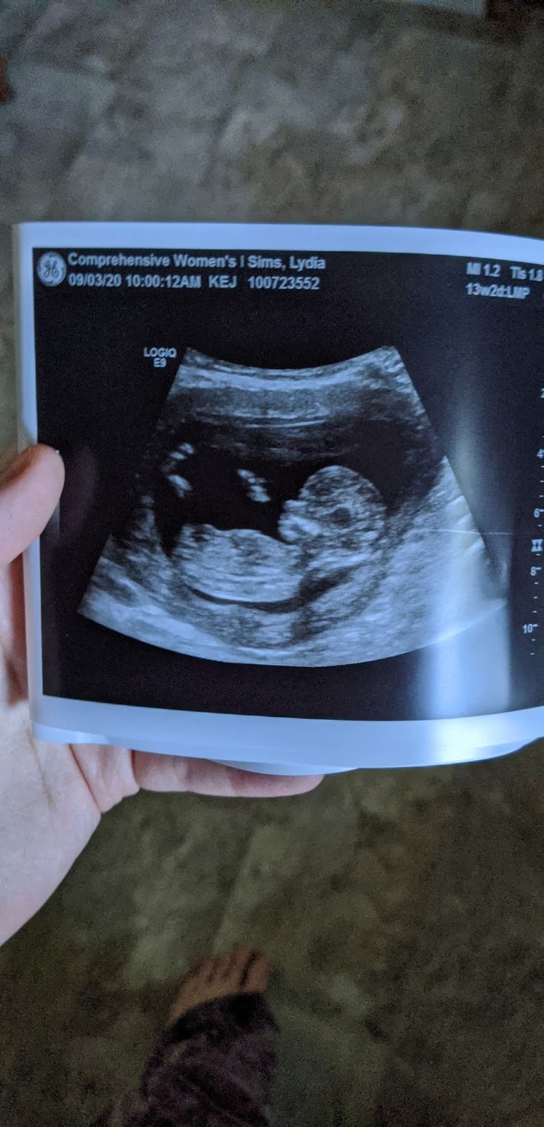 my first ultrasound